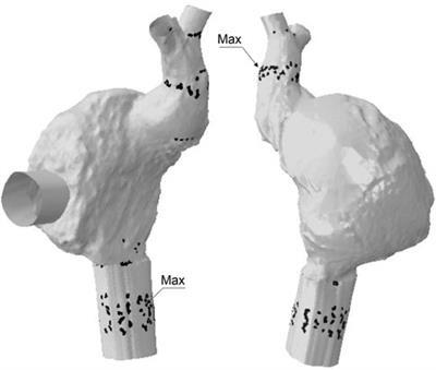 Biomechanical performance of the Bicaval Transcatheter System for the treatment of severe tricuspid regurgitation
